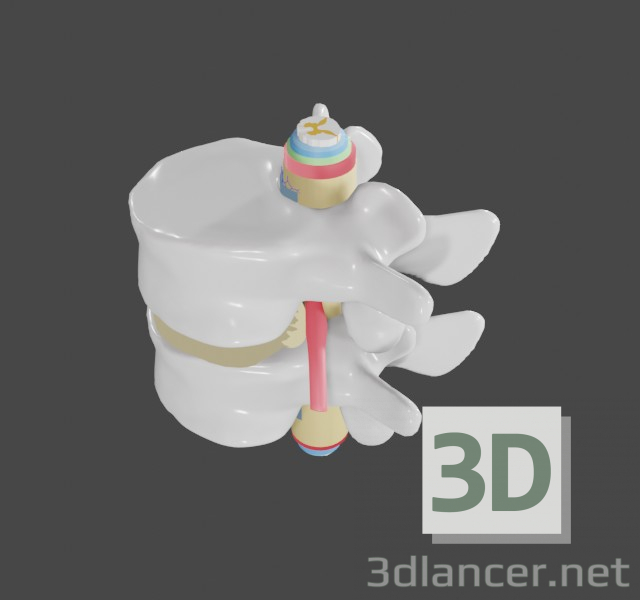 Hernia intervertebral en la columna lumbar. 3D modelo Compro - render
