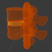 3D Lomber omurgada intervertebral fıtık modeli satın - render