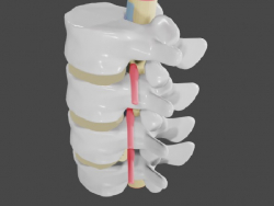 Protrusión y hernia en la columna lumbar.