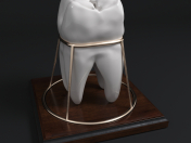 Tooth_Souvenir