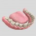 modello 3D Dentale carie - anteprima